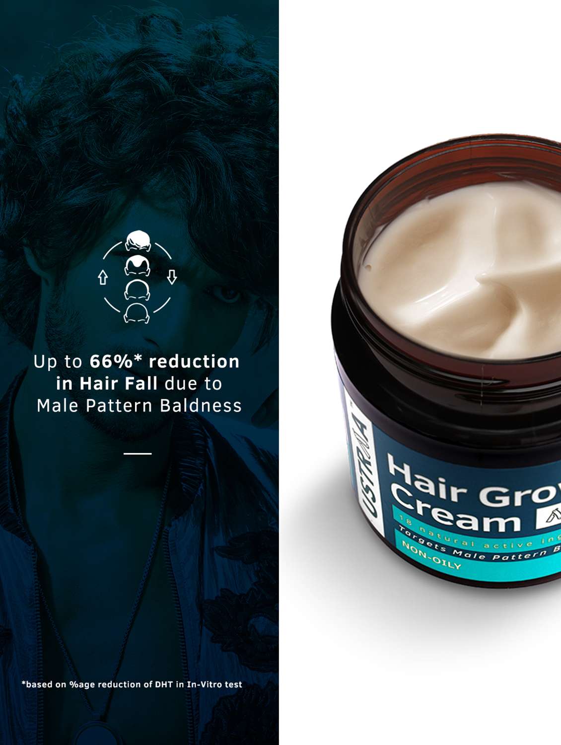 Ustraa Hair Growth Kit (Anti Hairfall Shampoo 250ml, Hair Growth Vitalizer & Cream)